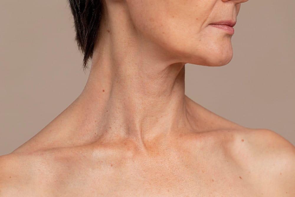 neck lift surgery