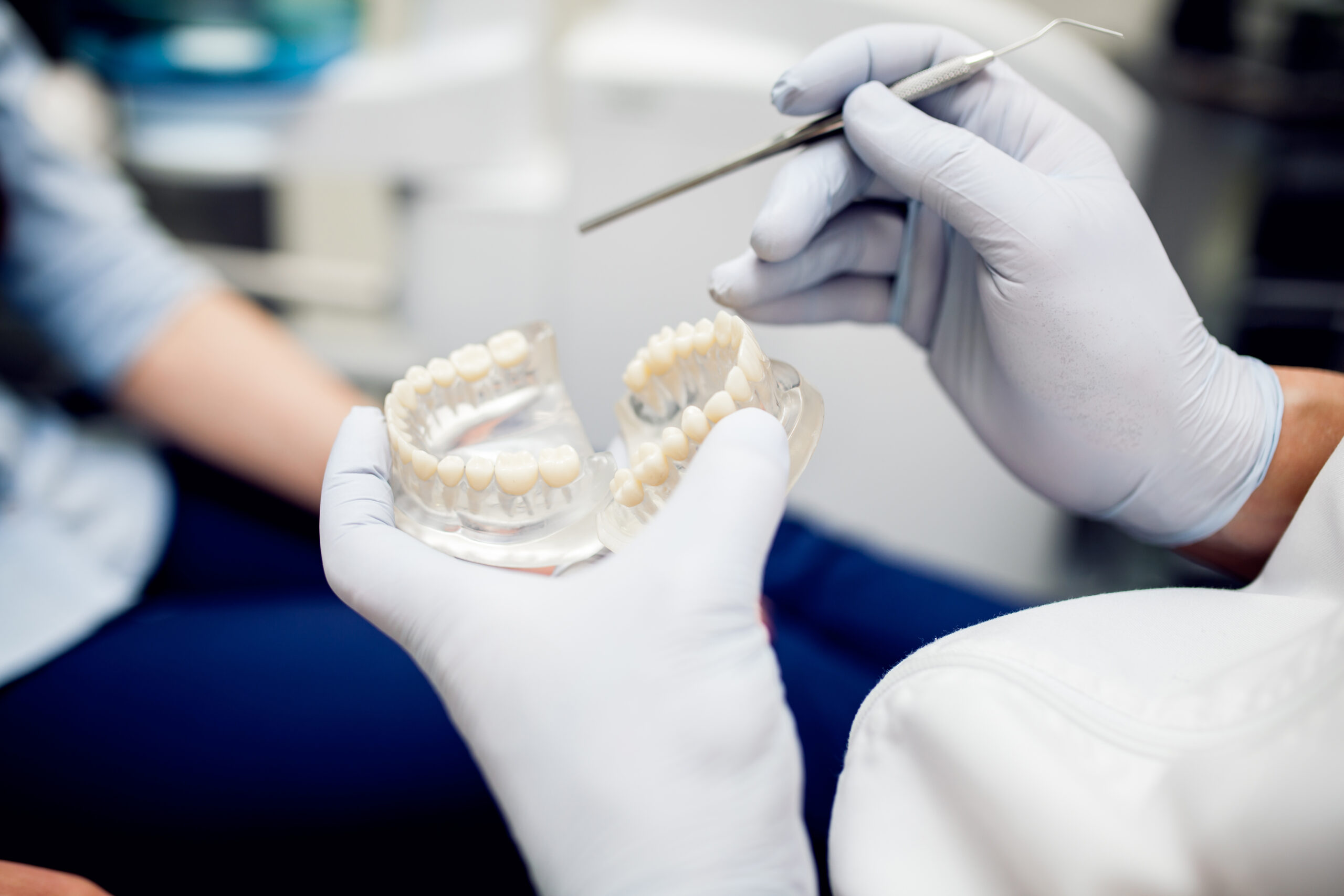 Do Dental Bridges Look Natural? Insights from Turkey's Top Dentists