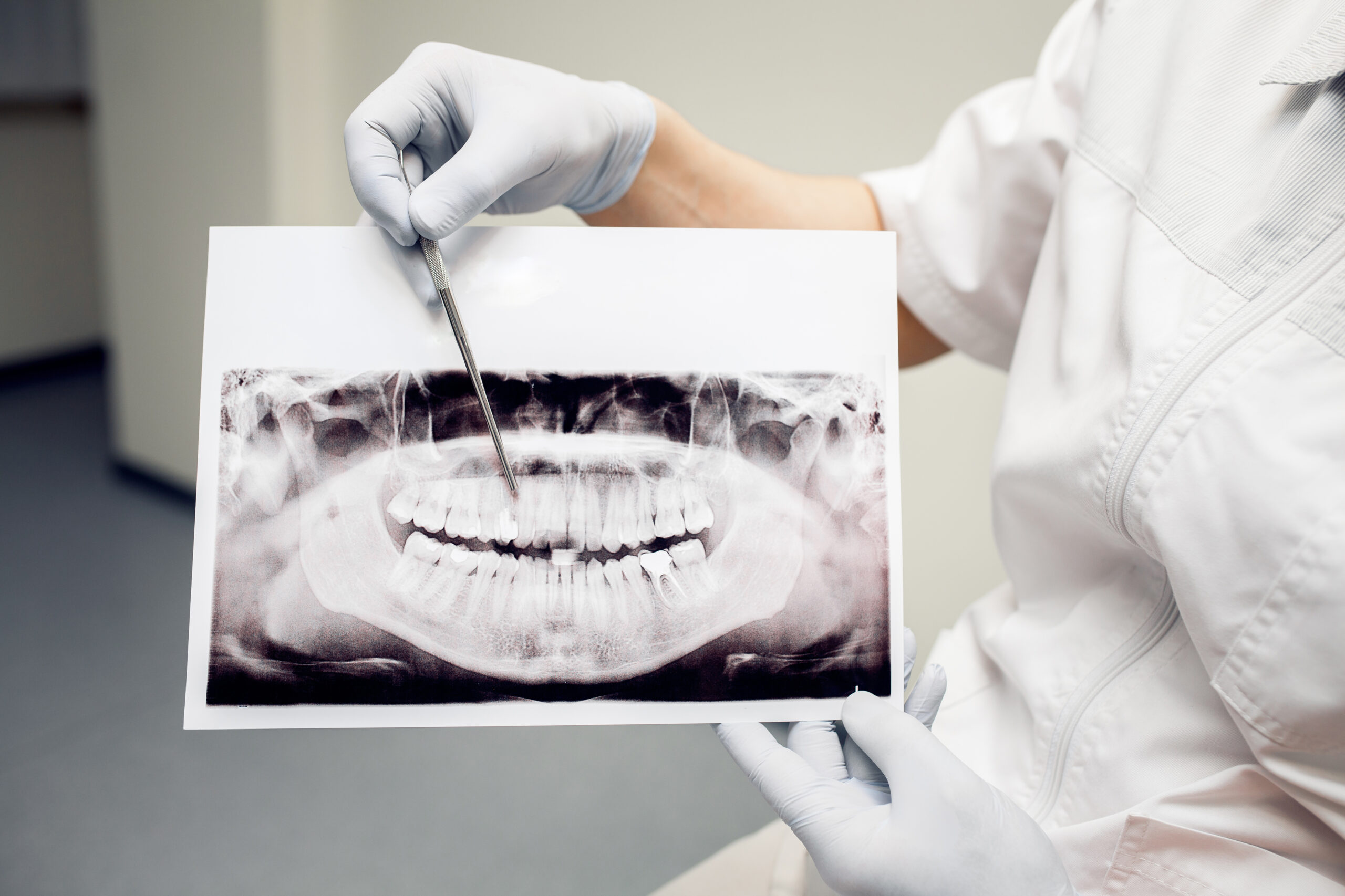 are dental implants expensive?