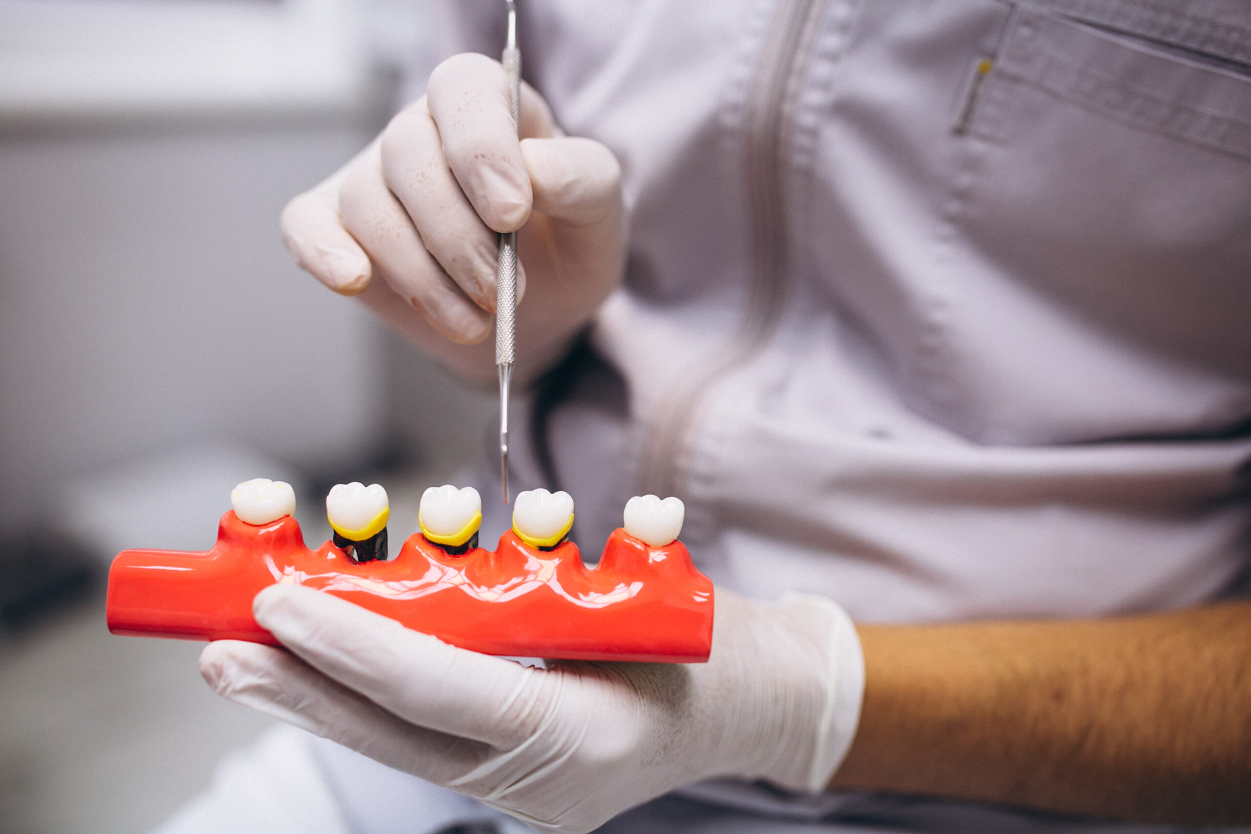Why Zirconia Crowns in Turkey Offer Superior Dental?